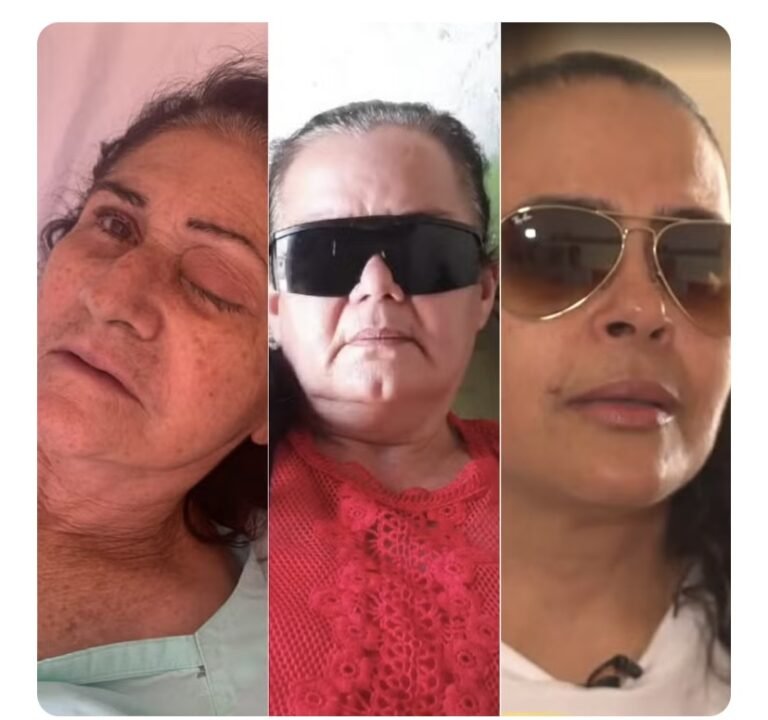 ‘Fui na esperança de enxergar’: veja relatos de pacientes infectados em mutirão de cataratas no RN ‘Fui na esperança de enxergar’: veja relatos de pacientes infectados em mutirão de cataratas no RN