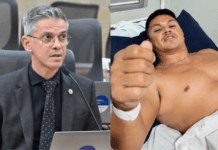 Deputado do PL diverge de Álvaro e elogia ação do Governo do RN após atentado